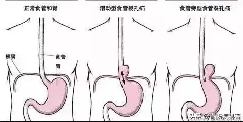 堵住尿孔不能尿按肚子知乎：探讨在特定情况下，如何通过物理方法缓解排尿困难的经验与建议