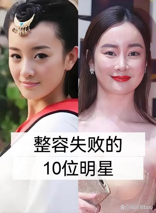 娱乐圈整容风潮深度调查_娱乐圈整容泛滥_娱乐圈整容成功的案例